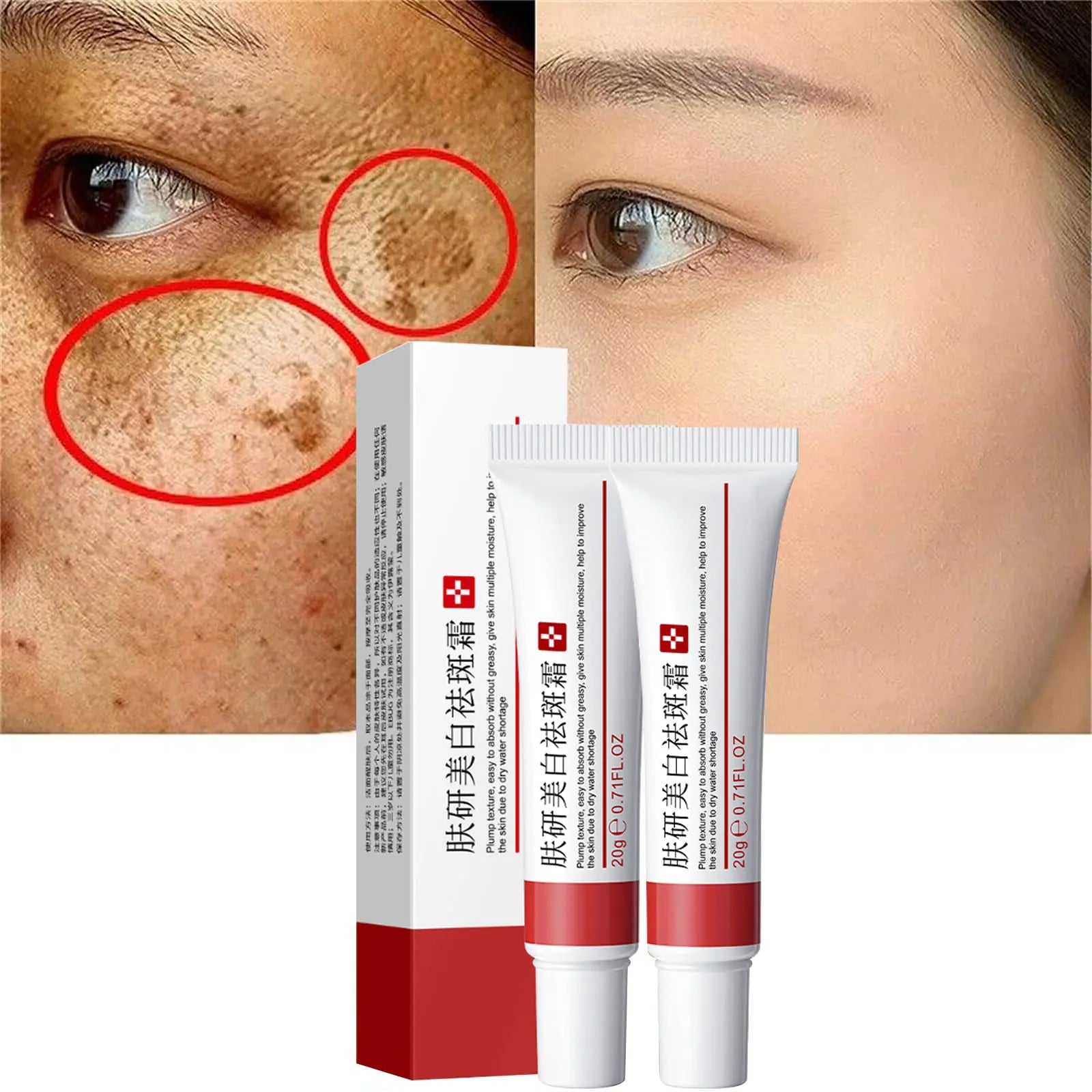 2 Pcs Freckle Cream Acne Scar Removal Treatment Cream Pigmentation Removal Cream for Face Moisturizing Removes Facial Melasma Dark Spots Wrinkles Blemishes (freckle cream)